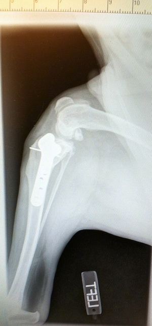 X-ray of Bruno's hip
