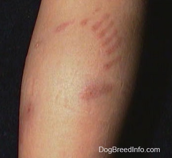 Close Up - dog bite teeth marks on the back of a leg