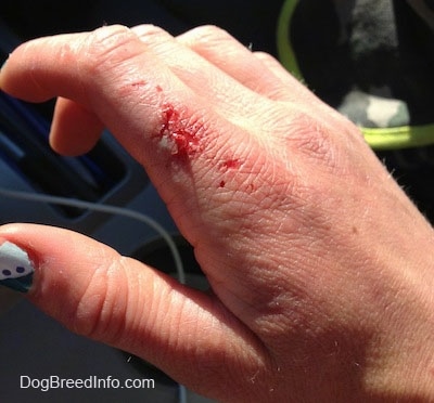 Close Up - bloody dog bite on the index finger