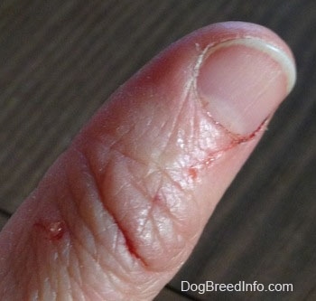 Close Up - Dog bite cut on an thumb