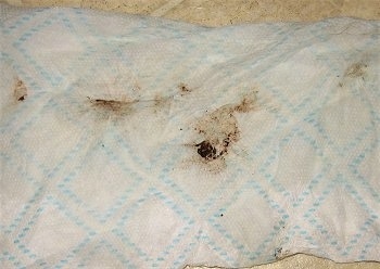 Dirty Paper towel from Bruno the Boxer puppy's ear