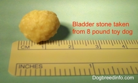 Large Bladder Stone placed at the top side of a ruler. It measures in at 1 and a half centimeters