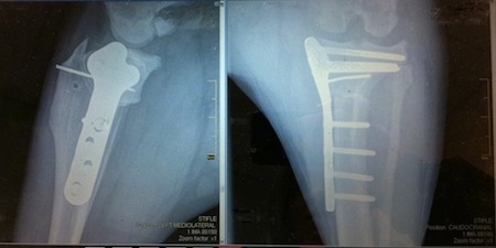 X-ray of Bruno the Boxers Knee with screws and plates in it