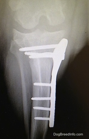 Close Up - x-ray of the plate and screws in Brunos leg