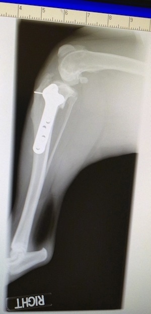 x-ray of Bruno's right leg with screws and plates inside