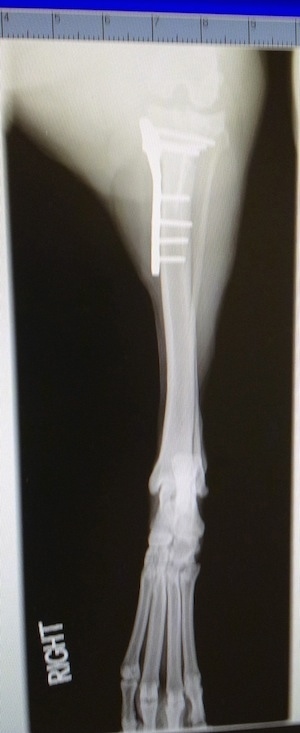 A second x-ray of Bruno's right leg with screws and plates inside from a different angle