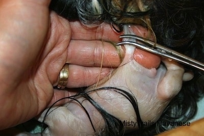 Close Up - Hemostat being used to hold the placenta