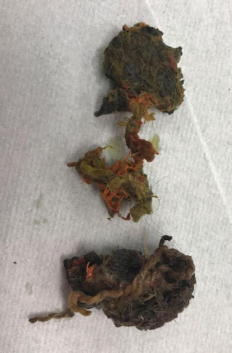A pile of chewed up tennis ball that was removed from the inside of a dog's intestinal track