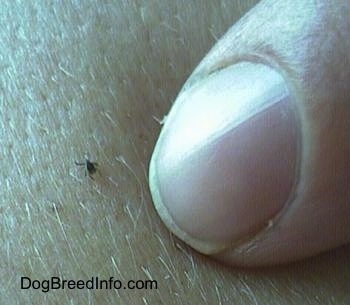 Close up - A tiny tick on a person's arm and a finger is pointing at the tick.